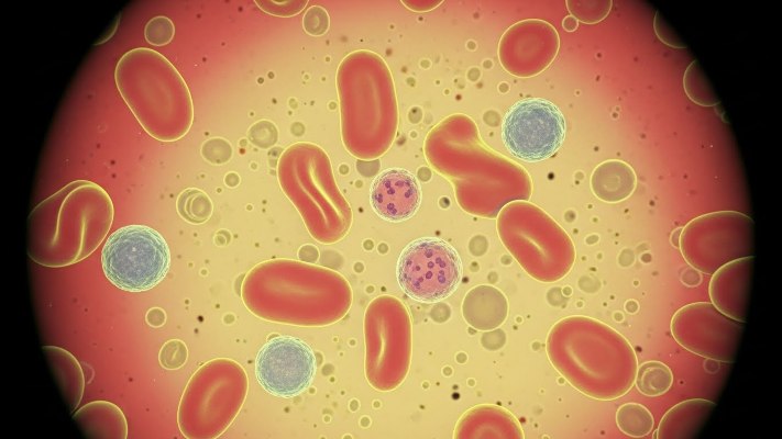 مقاله کمبود فقر آهن