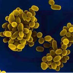 دانلود پاورپوینت بروسلوز ۱۴ اسلاید