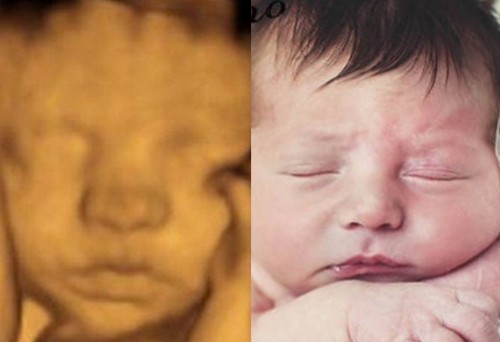 دانلود پاورپوینت بررسی رشد کودک قبل و بعد از تولد