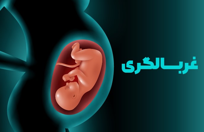 پاورپوینت اپیدمیولوژی بالینی غربالگری Screening اپیدمیولوژی بالینی غربالگری